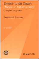Sindrome de Down: Hacia un futuro mejor